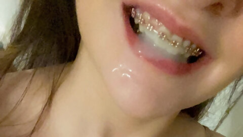 I loved his hot, thick cum covering my braces ?
